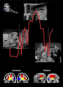 Long time non-responsive patient shows brain activity resembling that of healthy individuals while watching a Hitchcock movie. Photo Credit: Lorina Naci