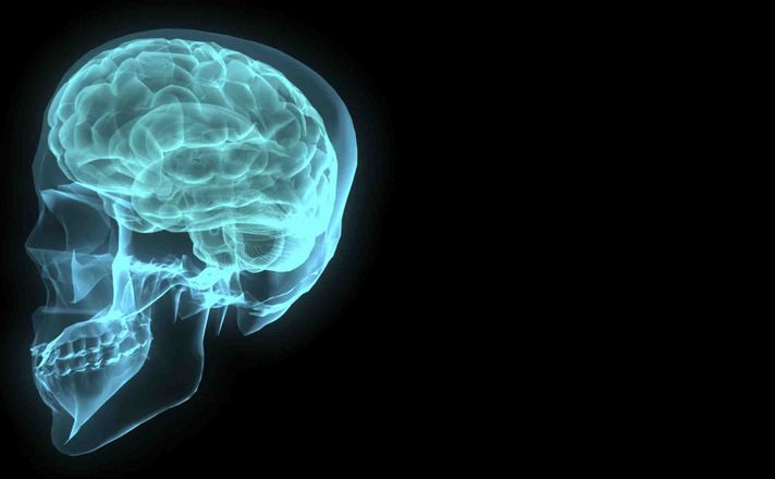 Western receives $66 million federal research grant to reduce burden of brain disorders