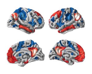 Lancet Brain April 27