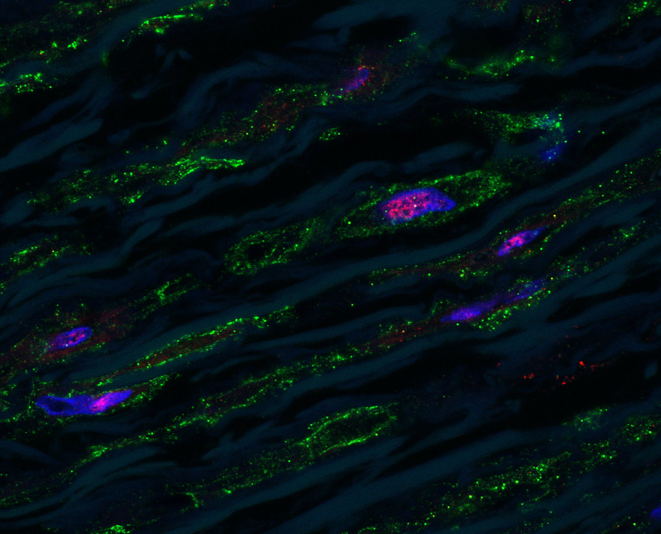 Scientists find potential way to defuse ‘time bomb’ of cardiology