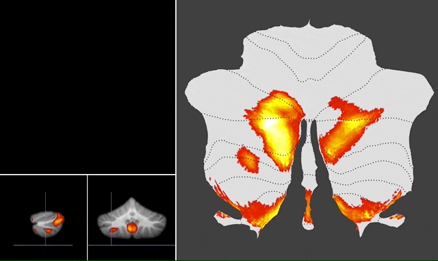 Western University develops first-of-its-kind task-based map of the human cerebellum