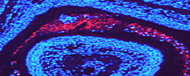 Get a sneak peek of new cutting-edge infectious diseases facility