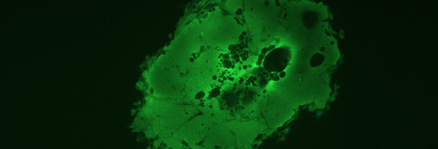 New research underscores the importance of the measles vaccine