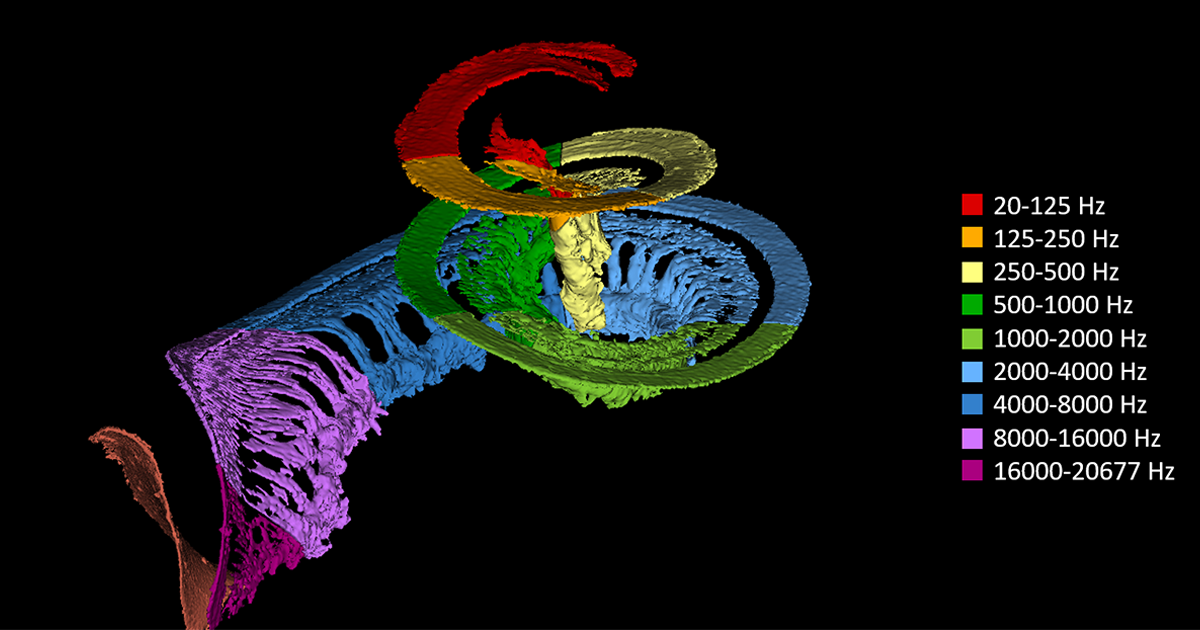 New tool helps ‘tune’ cochlear implants to improve hearing