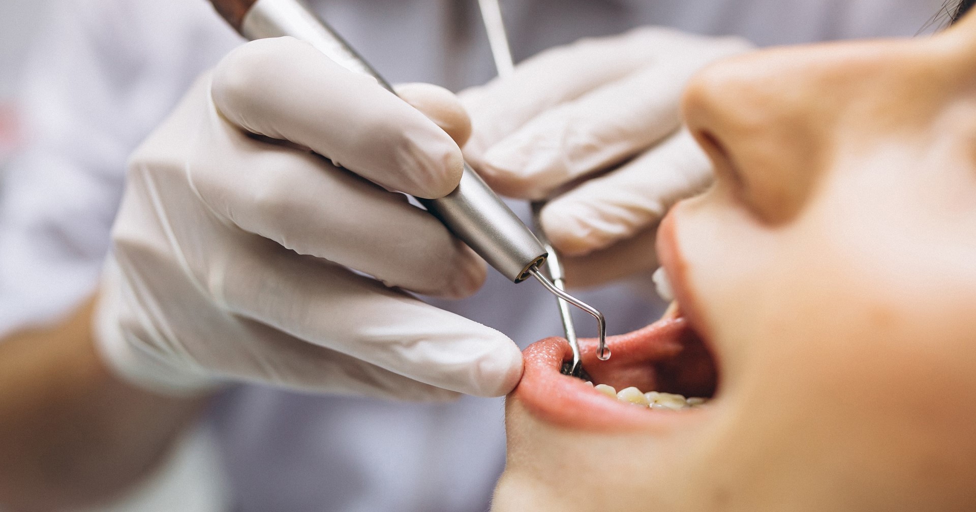 Experts available to comment on federal dental insurance program