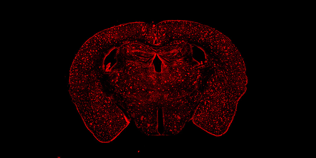 Researchers reveal link between Alzheimer’s disease and sex hormones