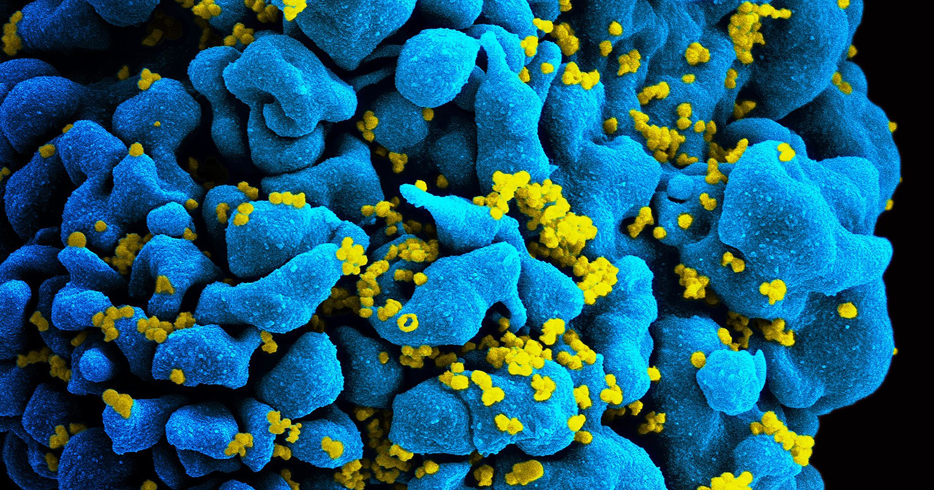Western experts available on the Canadian Conference on HIV/AIDS Research