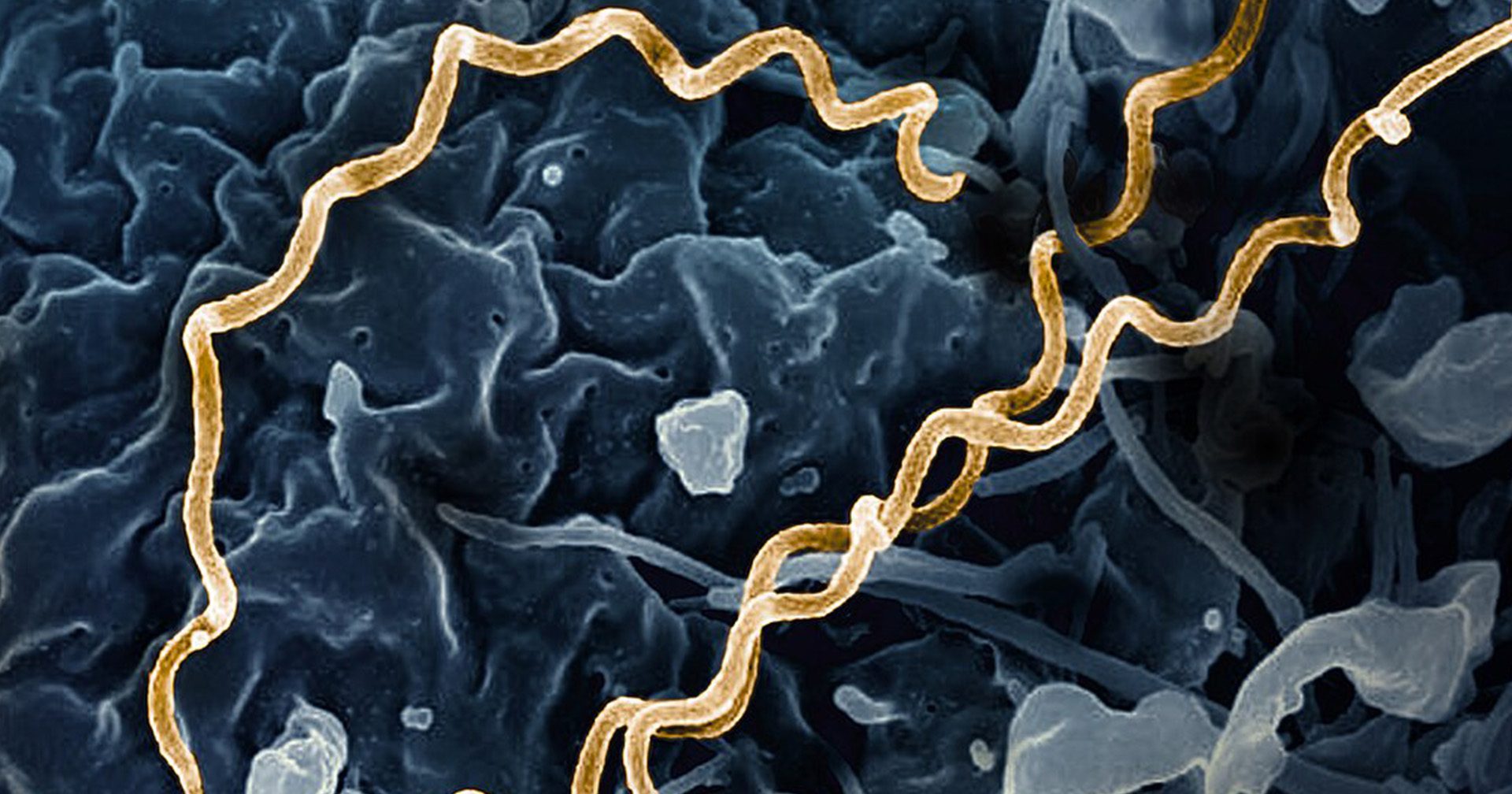 Why are syphilis cases on the rise in Canada?