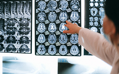 Gold nanoparticle medical imaging supporting cancer therapy | Global News Morning
