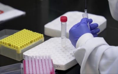 Private public partnership at Western seeks to make HIV treatment access more equitable around the world | CP24