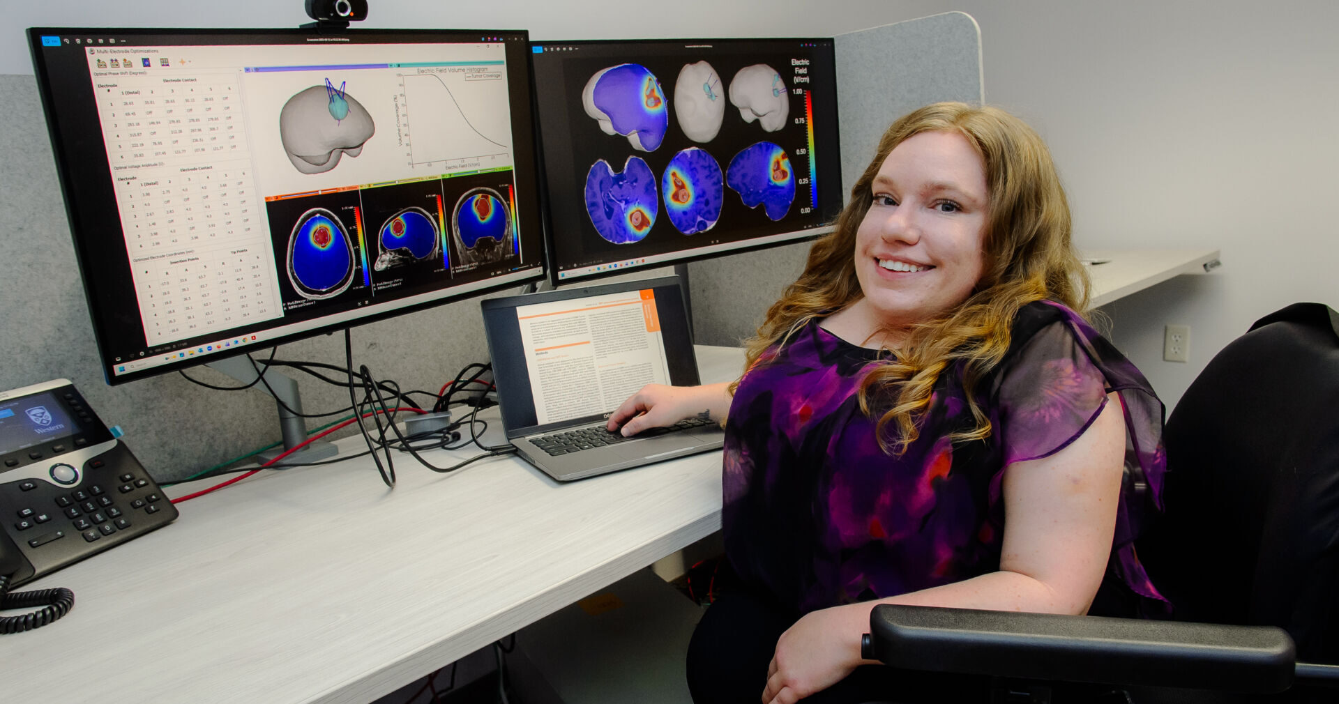Electric fields offer new hope against aggressive brain cancer, Western researchers find
